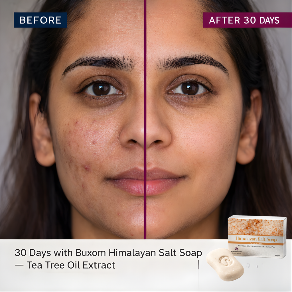 Himalayan Salt Soap | Tea Tree Oil Extract | Anti-Acne | Chemical Free - 90g