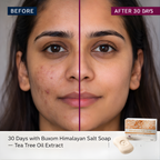 Himalayan Salt Soap | Tea Tree Oil Extract | Anti-Acne | Chemical Free - 90g