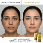 ALTER Sun Screen SPF 50 PA+++ | Broad Spectrum | UVA/UVB Ultra Protection | Non-Greasy & Invisible — 50ml