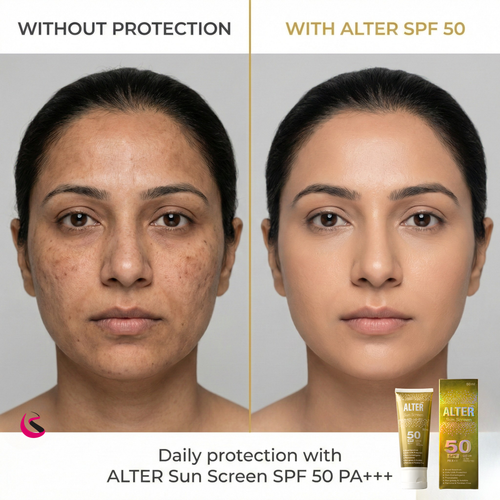 ALTER Sun Screen SPF 50 PA+++ | Broad Spectrum | UVA/UVB Ultra Protection | Non-Greasy & Invisible — 50ml