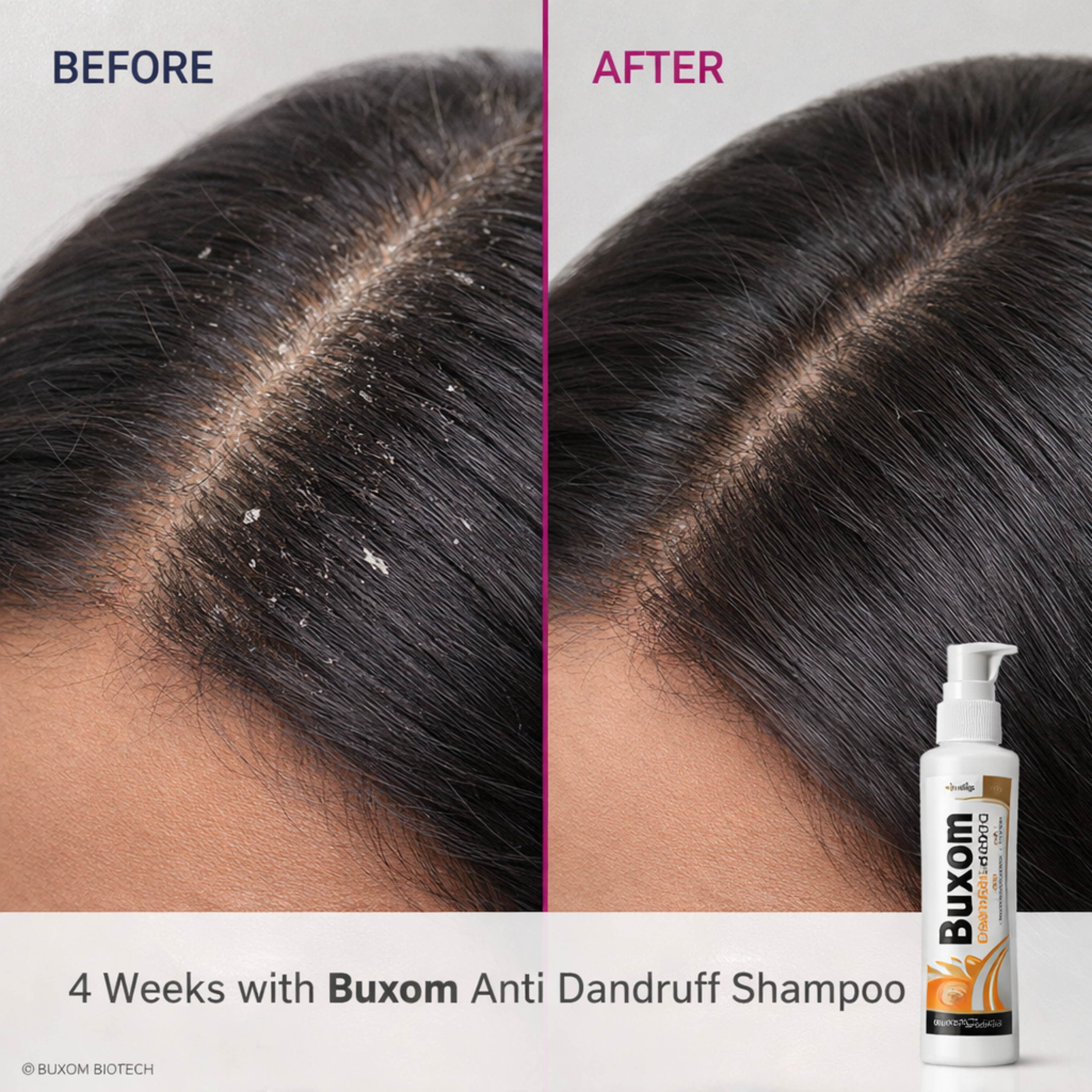 Buxom Anti Dandruff & Anti Fungal Shampoo with Biotin — 100ml