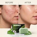 Moringa Organic Soap | Nourishing & Refreshing Bath Bar