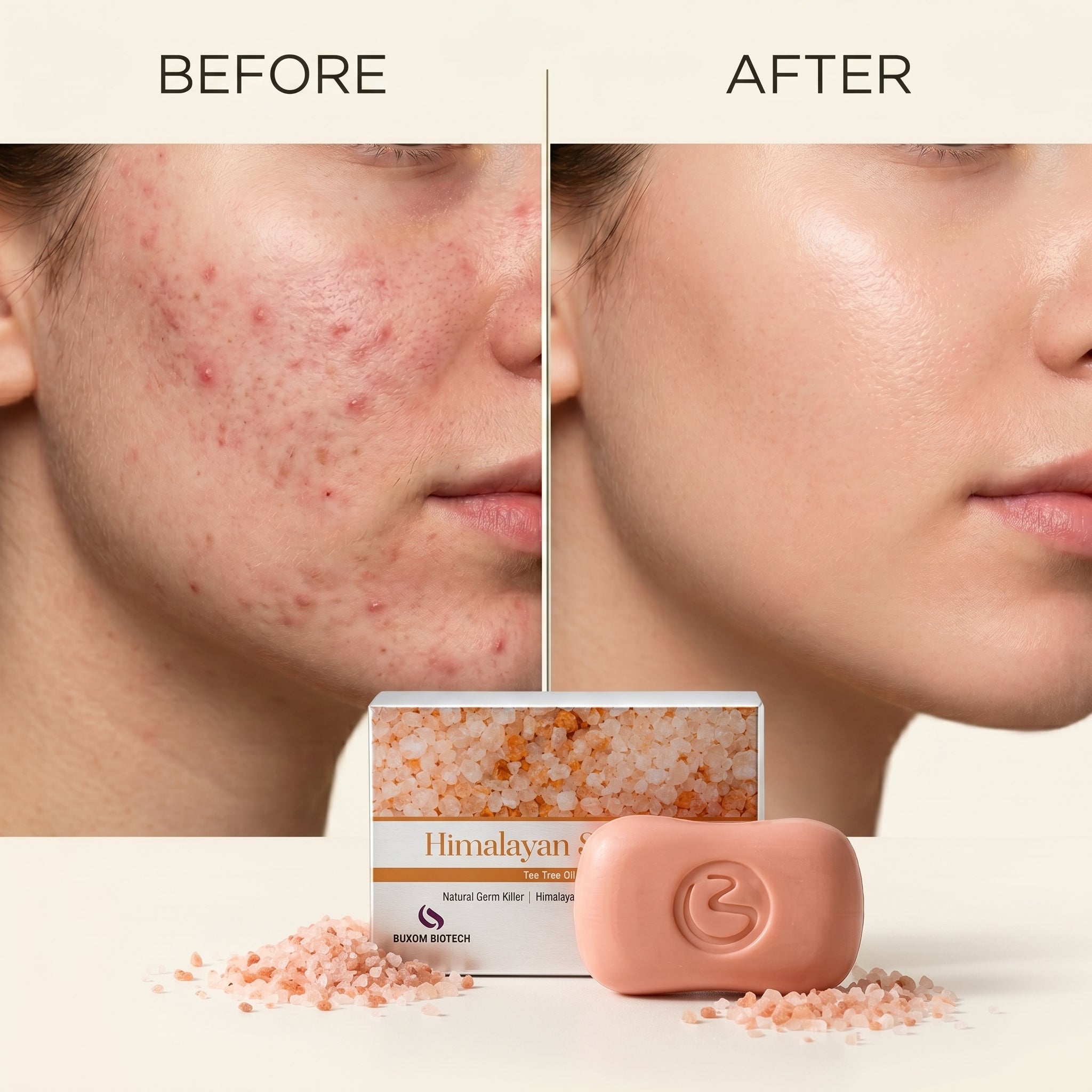 Himalayan Salt Soap | Tea Tree Oil Extract | Anti-Acne | Chemical Free - 90g