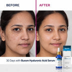 Hyaluronic Acid Serum