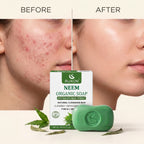 Organic Neem Soap